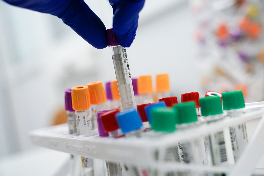 Эпидемиолог РАН: каждый сотый житель России заражен ВИЧ