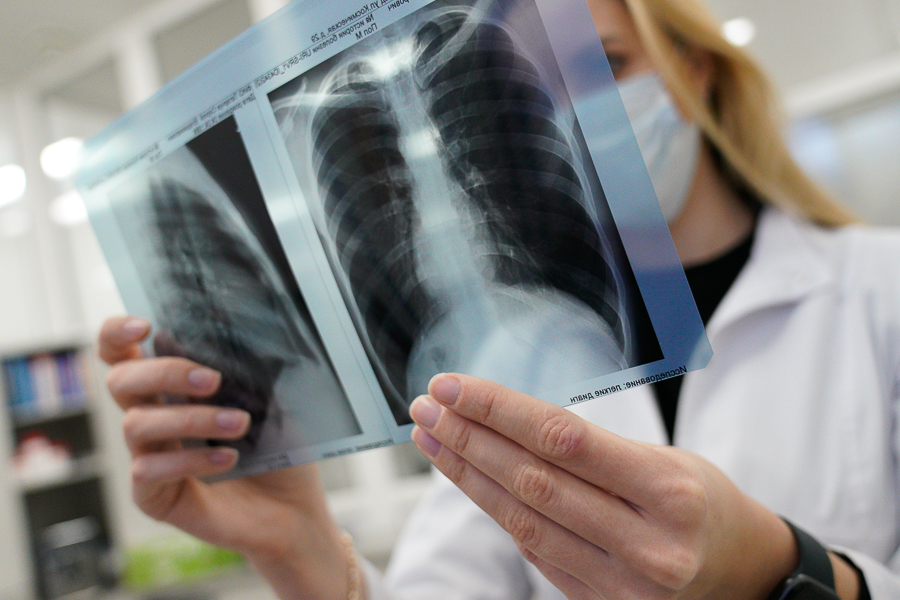 48 ОРВИ, 11 пневмоний: областные власти рассказали о случаях коронавируса за сутки