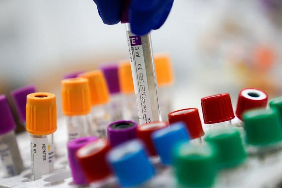 Cреди новых заражённых COVID в регионе — 17 сотрудников торговли и общепита