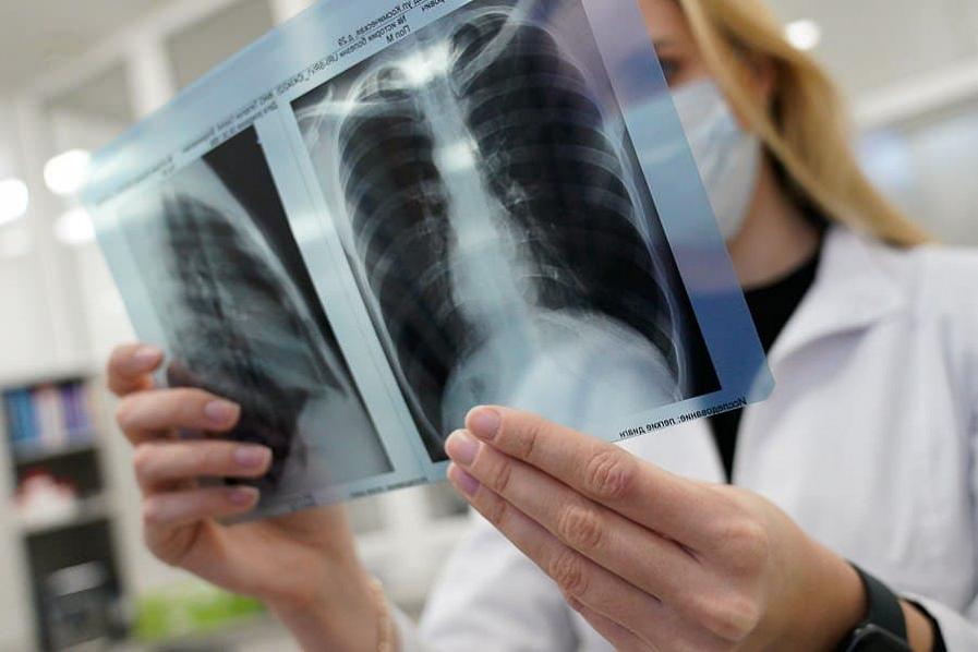 В Калининградской области зарегистрировали ещё две смерти от коронавируса