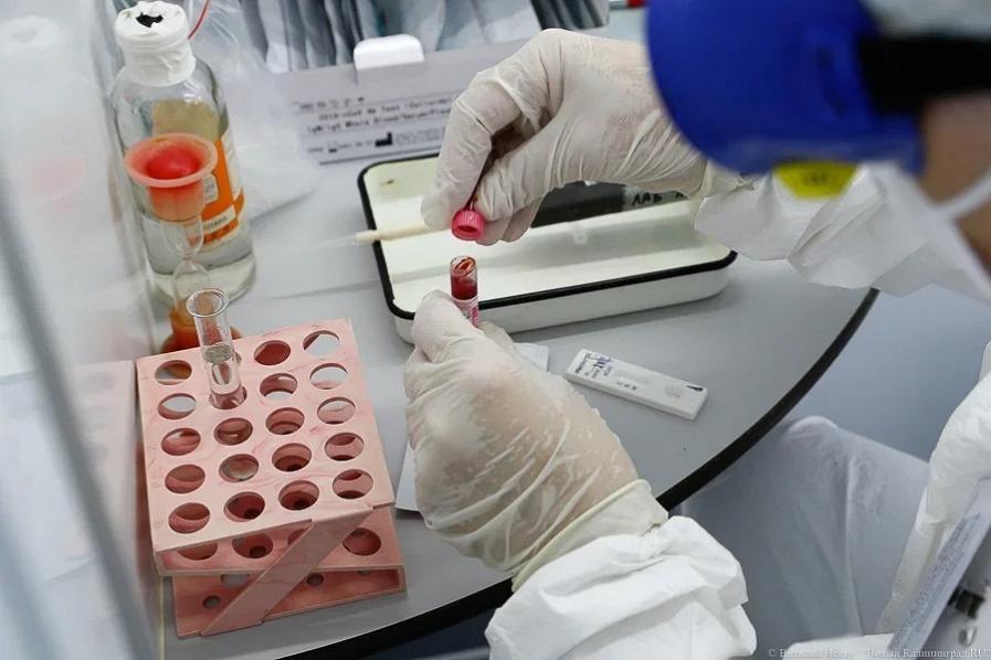 За сутки в регионе выявили менее ста случаев коронавируса