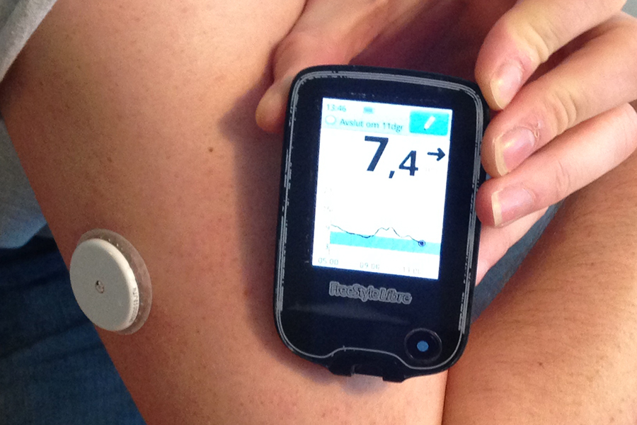 Облвласти: в пятницу в Калининграде пройдет акция по профилактике сахарного диабета