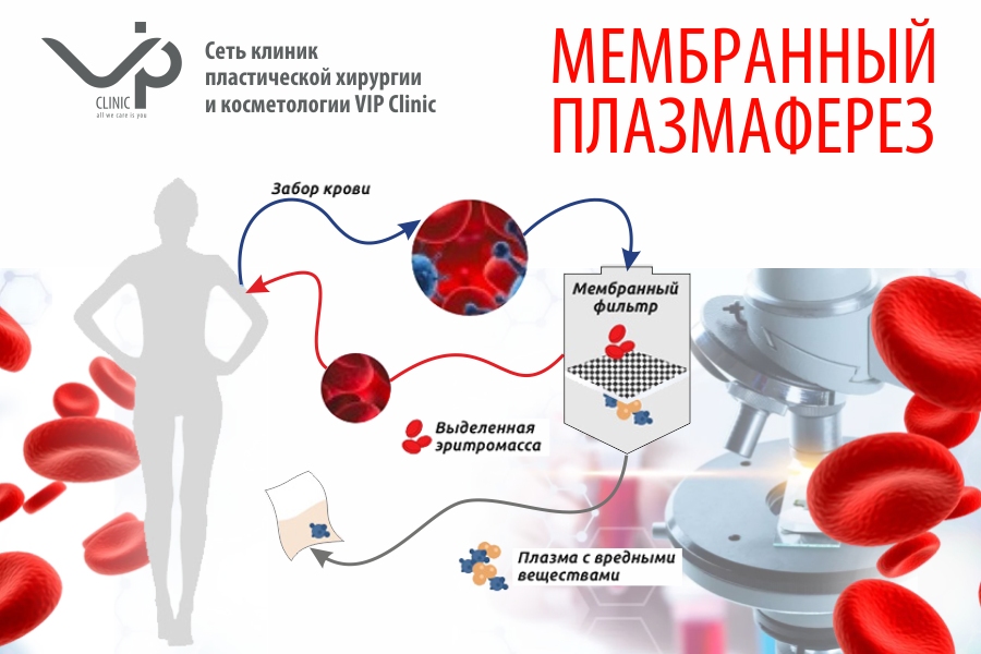 Плазмаферез при гепатите. Плазмаферез в поясницу. Пульс терапия кортикостероидами плазмаферез. Направление на кроводачу плазмаферез и др 404/у.